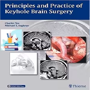 Principles and Practice of Keyhole Brain Surgery 1ed PDF Video at 2€ - کتاب پزشکی بهار