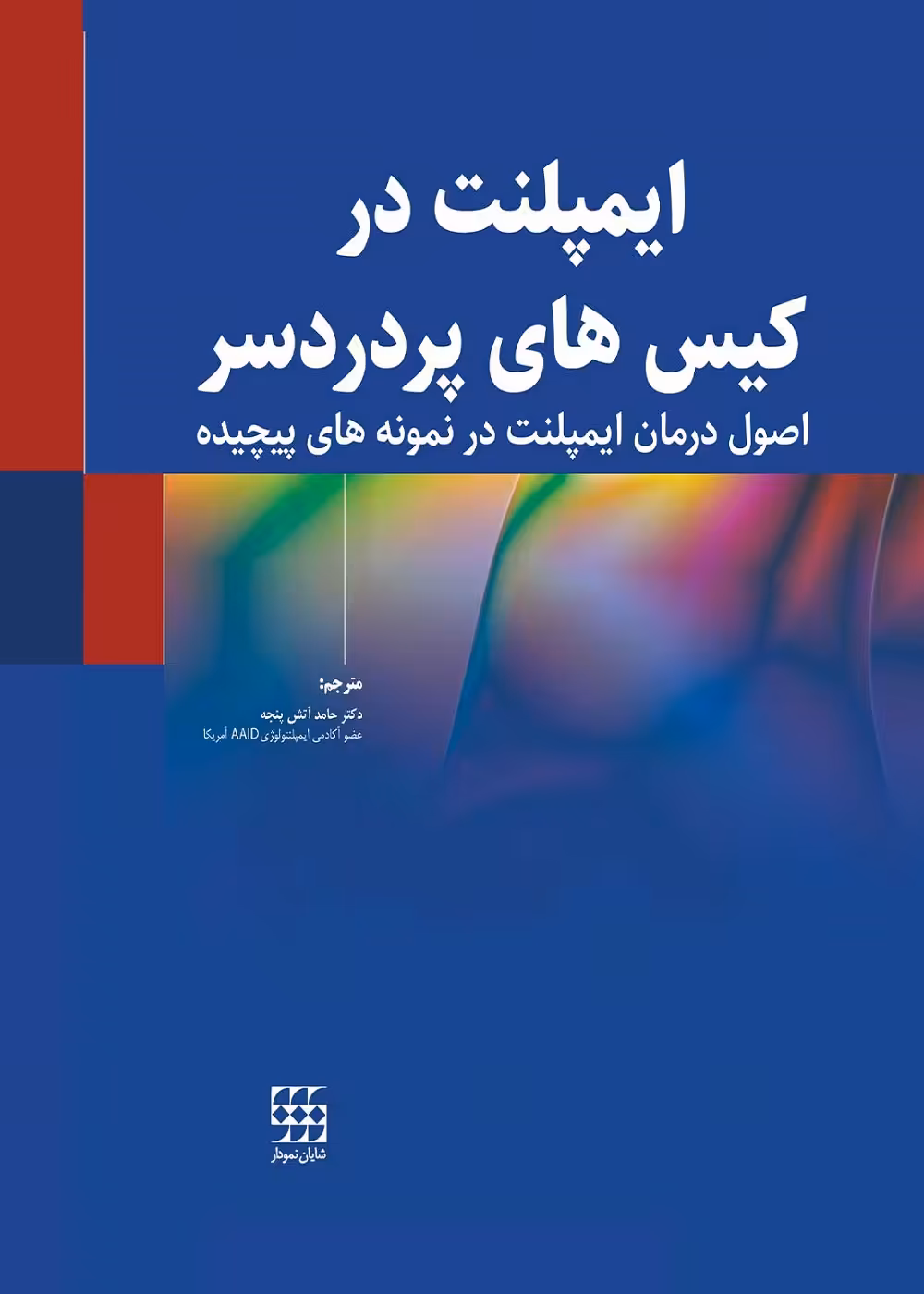 ایمپلنت در کیس های پردردسر (اصول درمان ایمپلنت در نمونه های پیچیده)