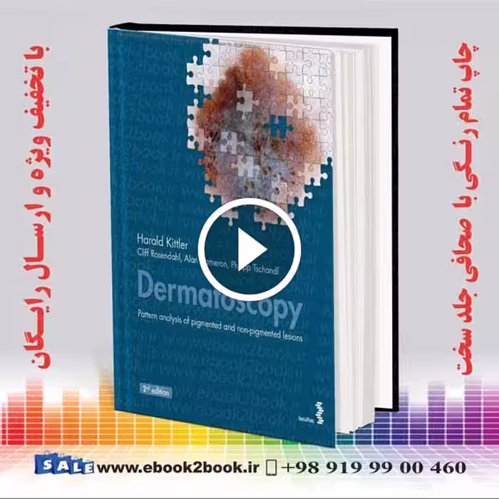 Dermatoscopy: Pattern analysis of pigmented and non-pigmented lesions