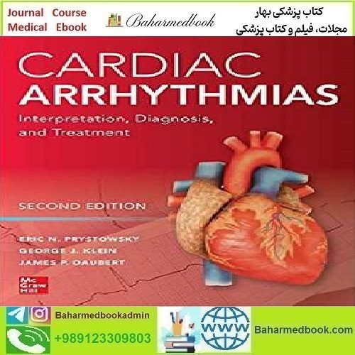 Cardiac Arrhythmias Interpretation Diagnosis and Treatment 2020