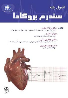 اصول پایه سندرم بروگادا