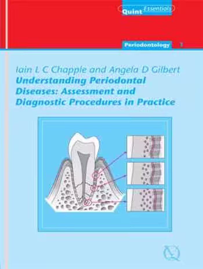 [EPUB] دانلود کتاب Understanding Periodontal Diseases - Quintessentials Of Dental Practice Vol. 1, 2010