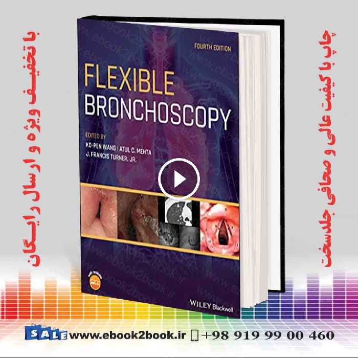 Flexible Bronchoscopy 4th Edition
