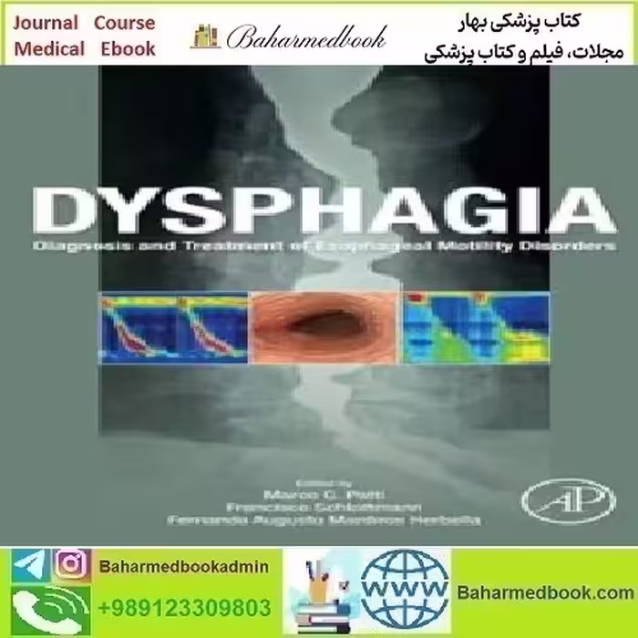 Dysphagia Diagnosis and Treatment of Esophageal Motility Disor