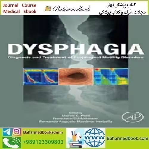 Dysphagia Diagnosis and Treatment of Esophageal Motility Disor