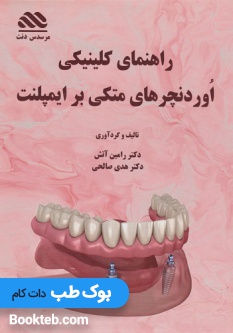 راهنمای کلینیکی اوردنچرهای متکی بر ایمپلنت