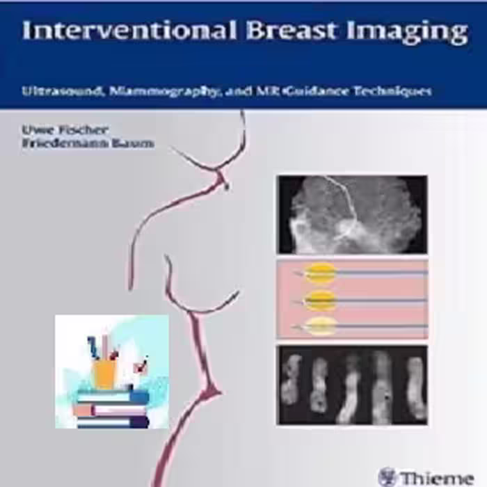 Interventional Breast Imaging TRUE PDF price 1€