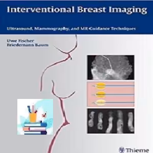 Interventional Breast Imaging TRUE PDF price 1€