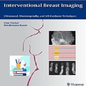 Interventional Breast Imaging TRUE PDF price 1€