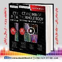CT and MRI of the Whole Body 2-Volume Set 6th Edition | هاگا و بول