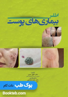 اطلس بیماری های پوست