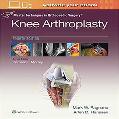 کتاب Master Techniques in Orthopedic Surgery Knee Arthroplasty اثر Mark W. Pagnano and Arien D.Hanssen انتشارات لیپین کات