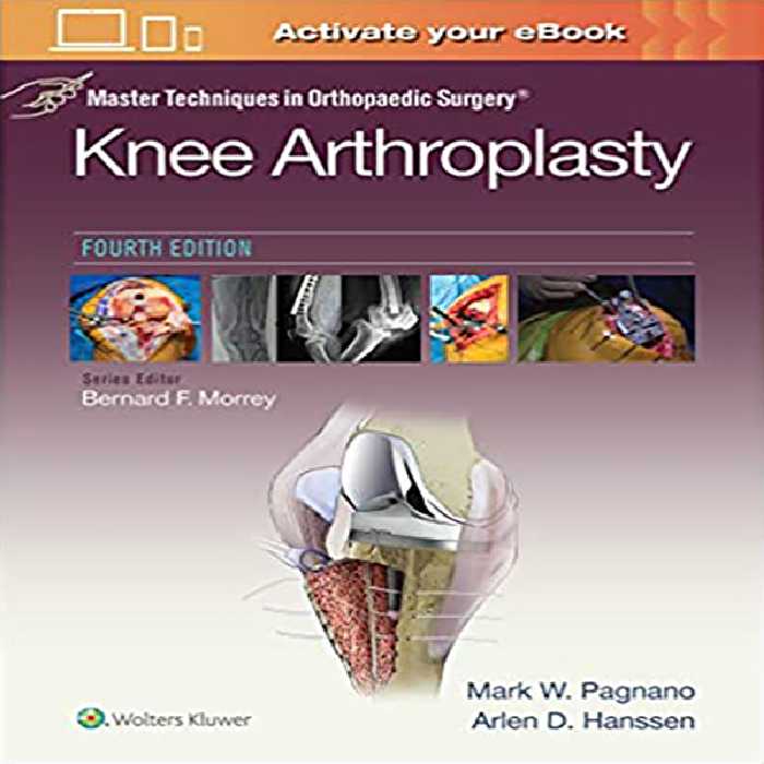 کتاب Master Techniques in Orthopedic Surgery Knee Arthroplasty اثر Mark W. Pagnano and Arien D.Hanssen انتشارات لیپین کات