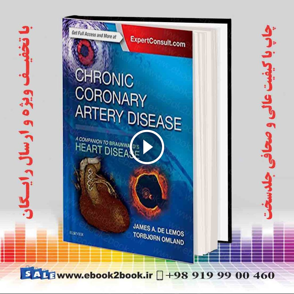 Chronic Coronary Artery Disease