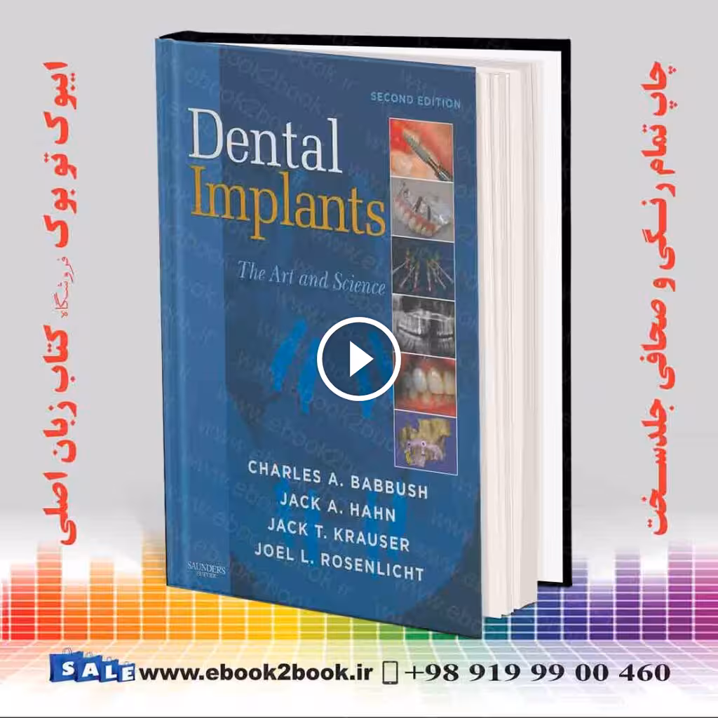 Dental Implants: The Art and Science 2nd Edition