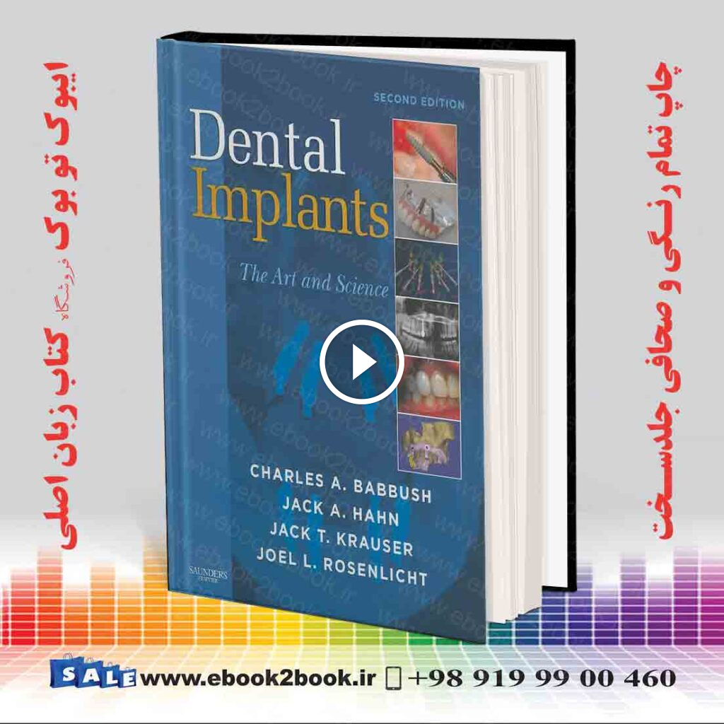 Dental Implants: The Art and Science 2nd Edition