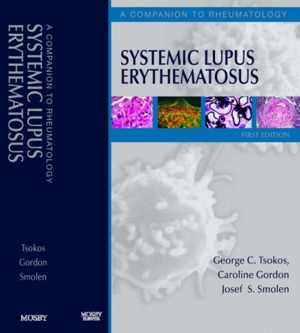 [PDF] دانلود کتاب Systemic Lupus Erythematosus - A Companion To Rheumatology, 2007