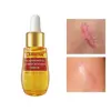 سرم لنبنا مدل Scar removal حجم 20 میلی لیتر