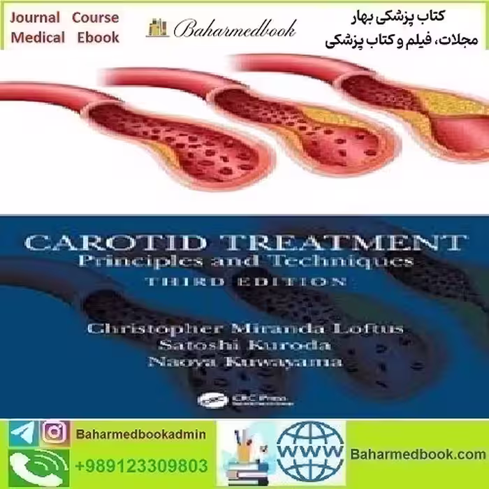 Carotid Treatment Principles and Techniques 2023 TR