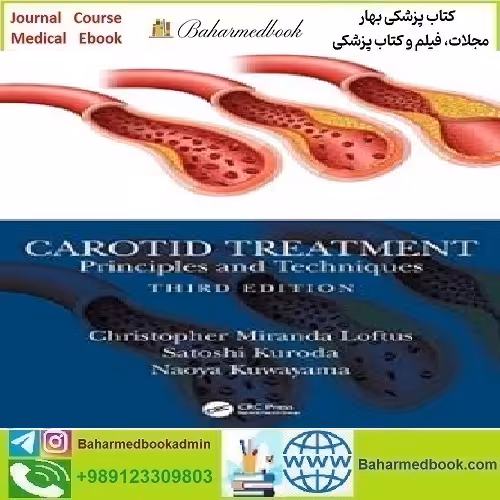 Carotid Treatment Principles and Techniques 2023 TR