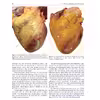 کتاب Atlas of Heart Anatomy and Development اثر Florin Mihail Filipoiu انتشارات Springer