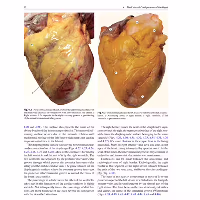 کتاب Atlas of Heart Anatomy and Development اثر Florin Mihail Filipoiu انتشارات Springer