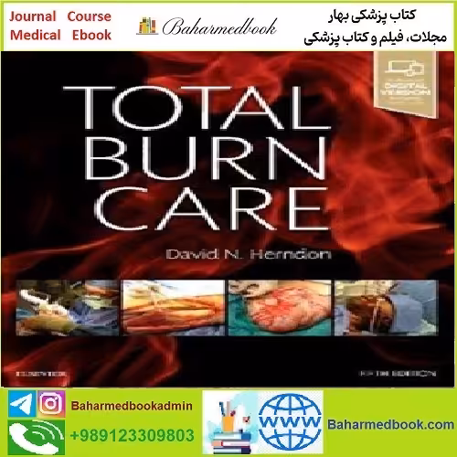 Total Burn Care TRUE PDF price 1€ - کتاب پزشکی بهار