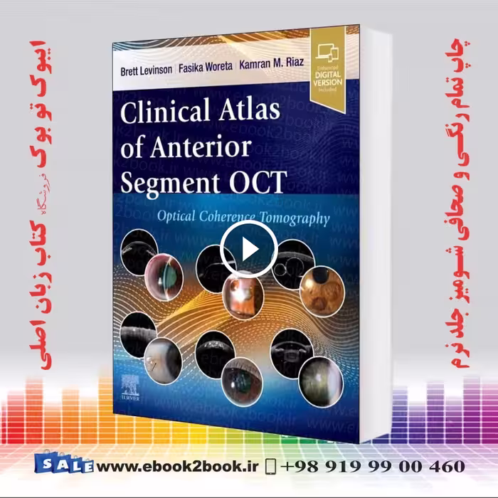 Clinical Atlas of Anterior Segment OCT: Optical Coherence Tomography