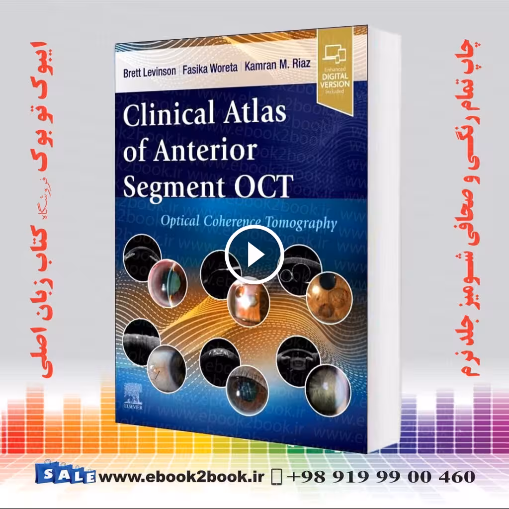 Clinical Atlas of Anterior Segment OCT: Optical Coherence Tomography