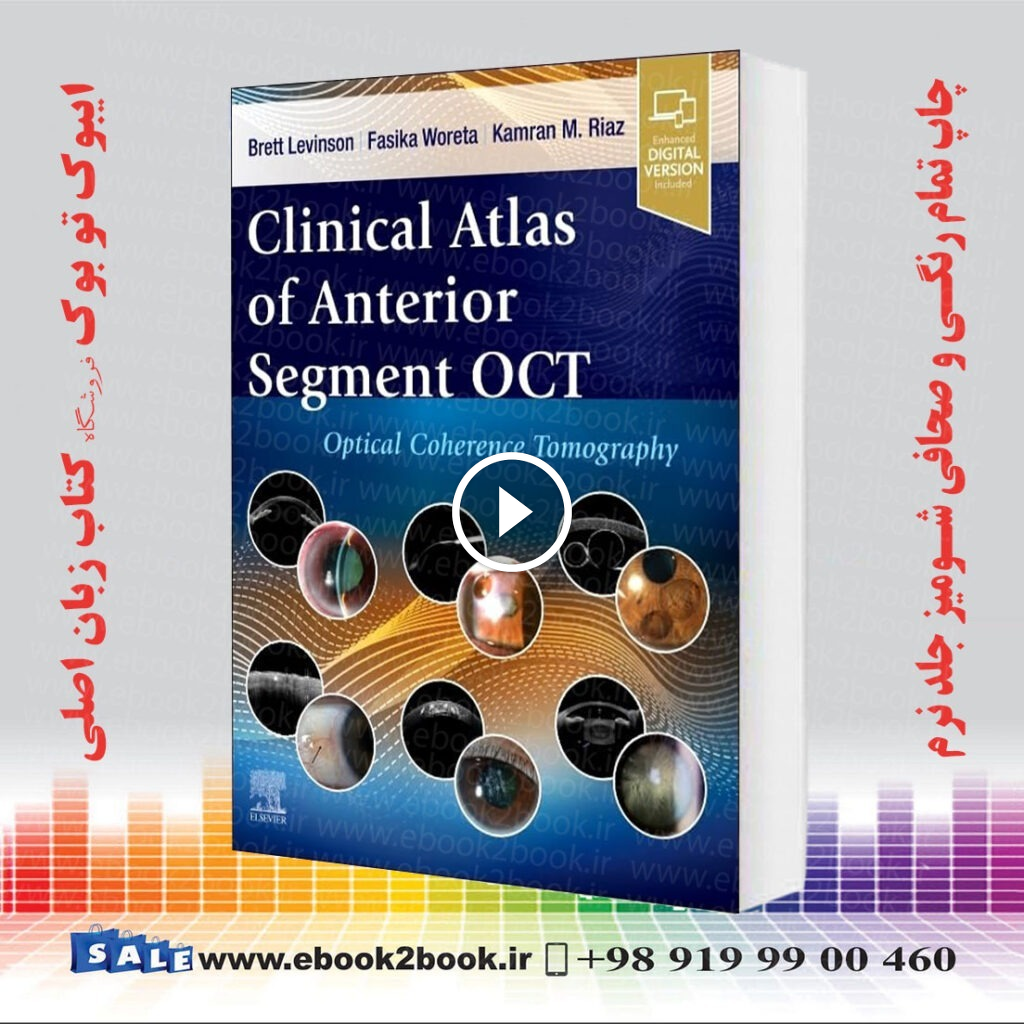 Clinical Atlas of Anterior Segment OCT: Optical Coherence Tomography