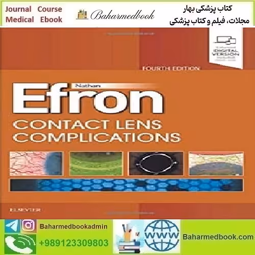 Contact Lens Complications 2019 TRUE PDF price 1€ - کتاب پزشکی بهار