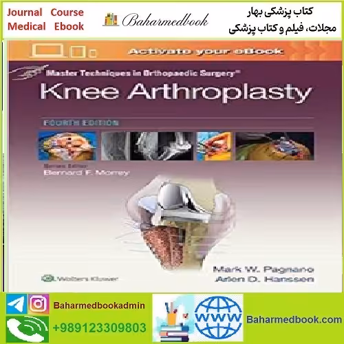 Master Techniques in Orthopedic Surgery Knee Arthroplasty C