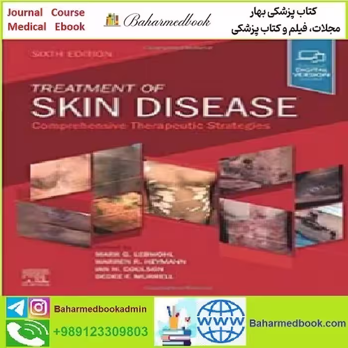 Treatment of Skin Disease Comprehensive Therapeutic Strategie
