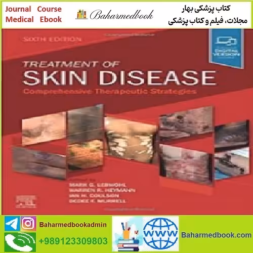 Treatment of Skin Disease Comprehensive Therapeutic Strategie