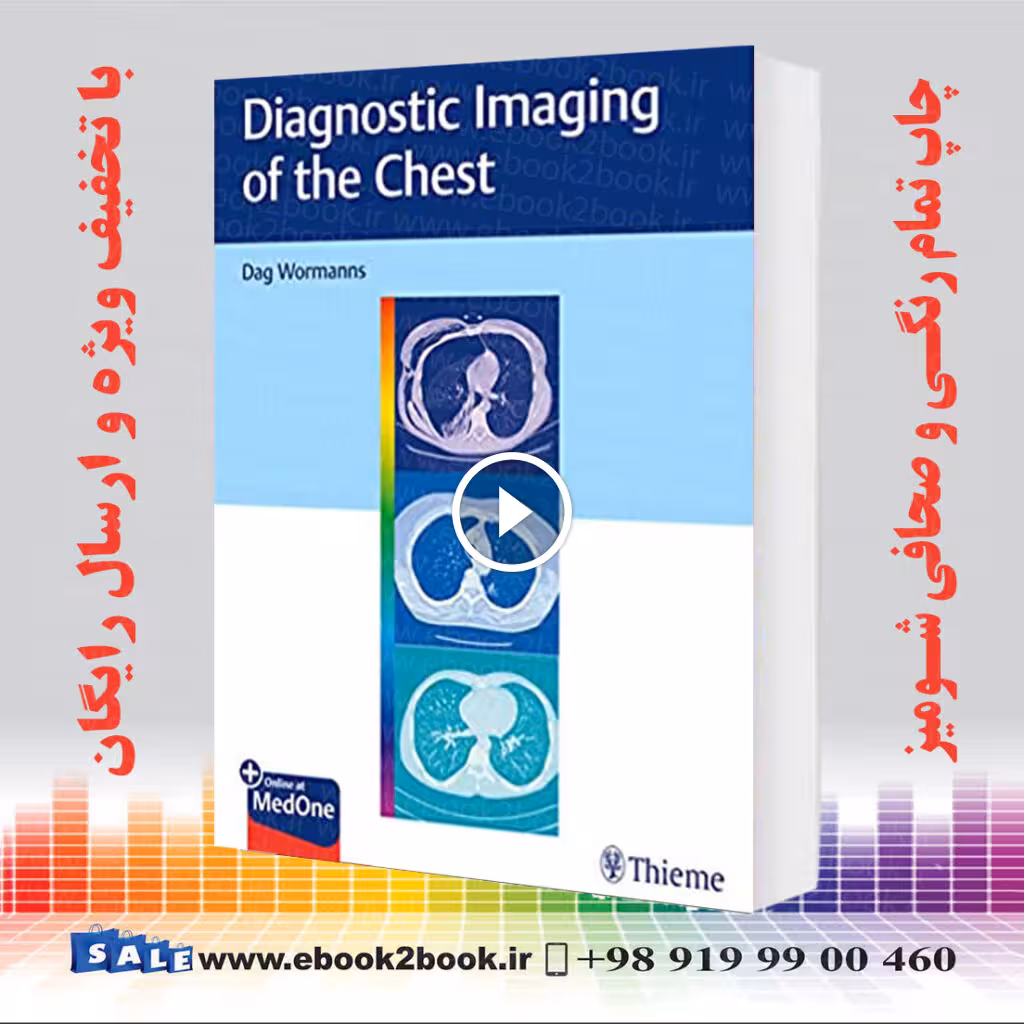 Diagnostic Imaging of the Chest
