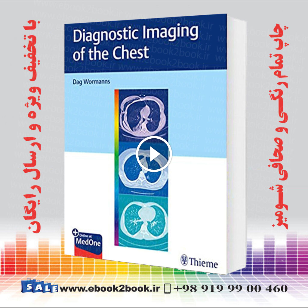 Diagnostic Imaging of the Chest