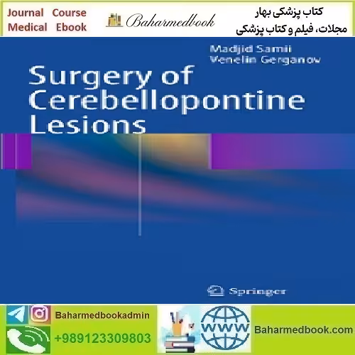 Surgery of Cerebellopontine Lesions 2014 TRUE PDF price 1€ - کتاب پزشکی بهار