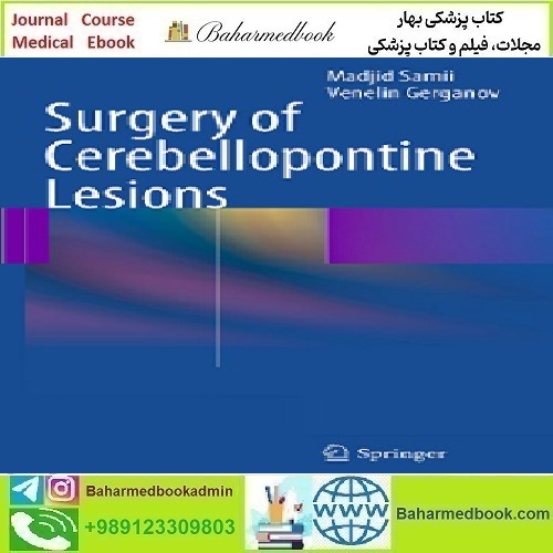 Surgery of Cerebellopontine Lesions 2014 TRUE PDF price 1€ - کتاب پزشکی بهار