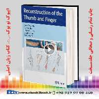 Reconstruction of the Thumb and Finger