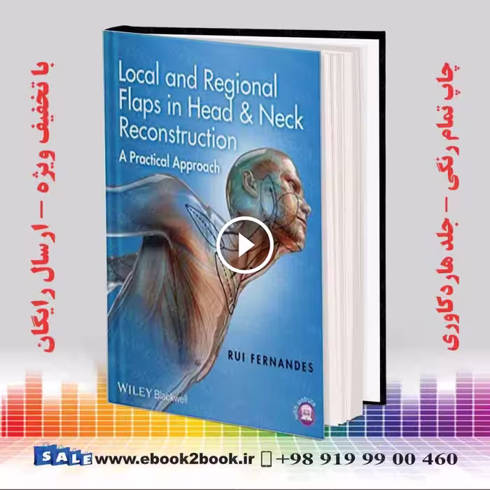 Local and Regional Flaps in Head and Neck Reconstruction