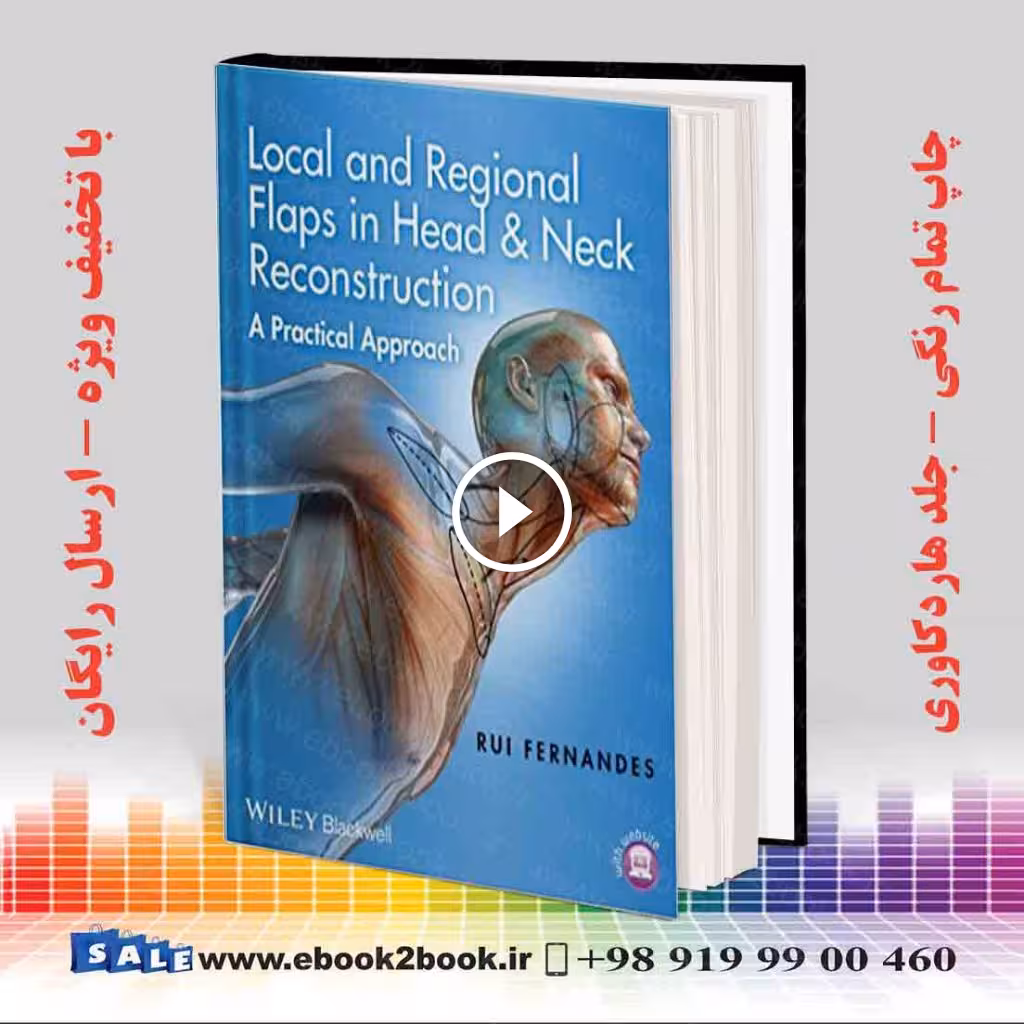 Local and Regional Flaps in Head and Neck Reconstruction