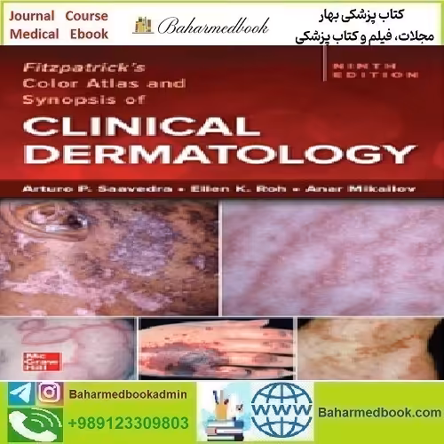 Fitzpatrick's Color Atlas and Synopsis of Clinical Dermatology 2