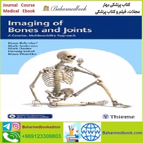 Imaging of Bones and Joints A Concise Multimodality Approach