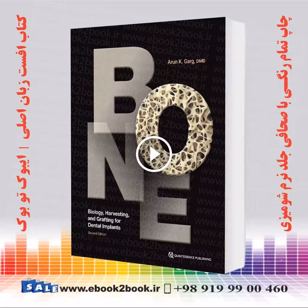 Bone: Biology, Harvesting, and Grafting for Dental Implants