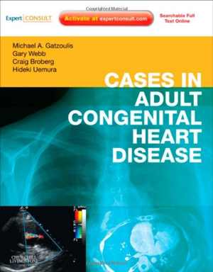 [PDF] دانلود کتاب Cases In Adult Congenital Heart Disease, 2009