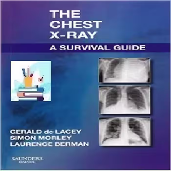 The Chest X-Ray TRUE PDF price 1€