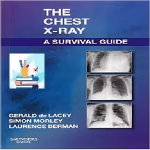 The Chest X-Ray TRUE PDF price 1€