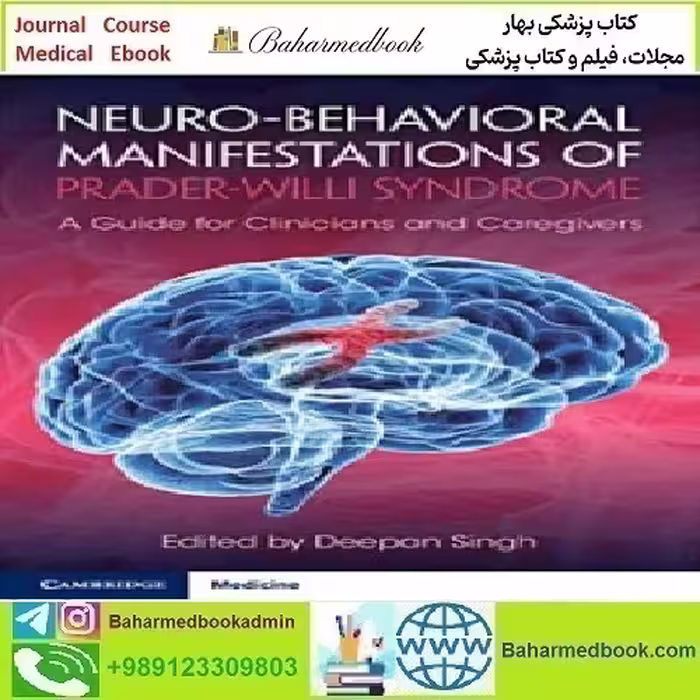 Neuro behavioral Manifestations of Prader Willi Syndrome 2022 TR