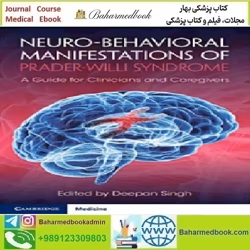 Neuro behavioral Manifestations of Prader Willi Syndrome 2022 TR