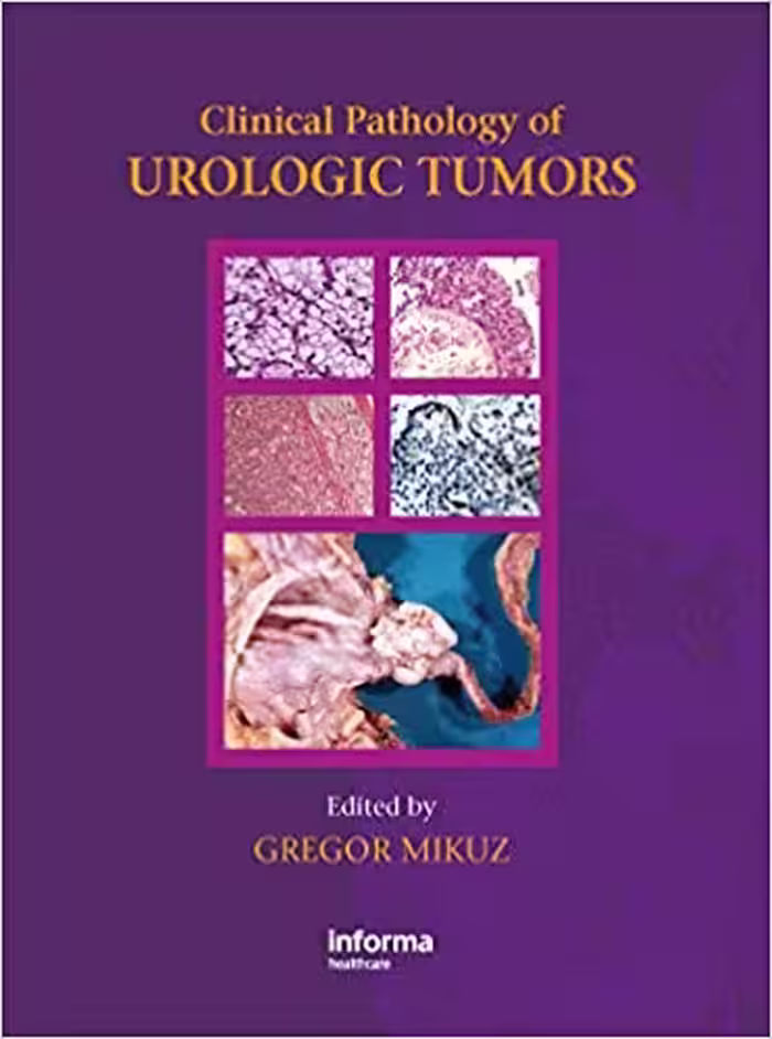 󾕇 دانلود کتاب Clinical Pathology Of Urological Tumours, 2007 - دانلود کتاب های دانشگاهی